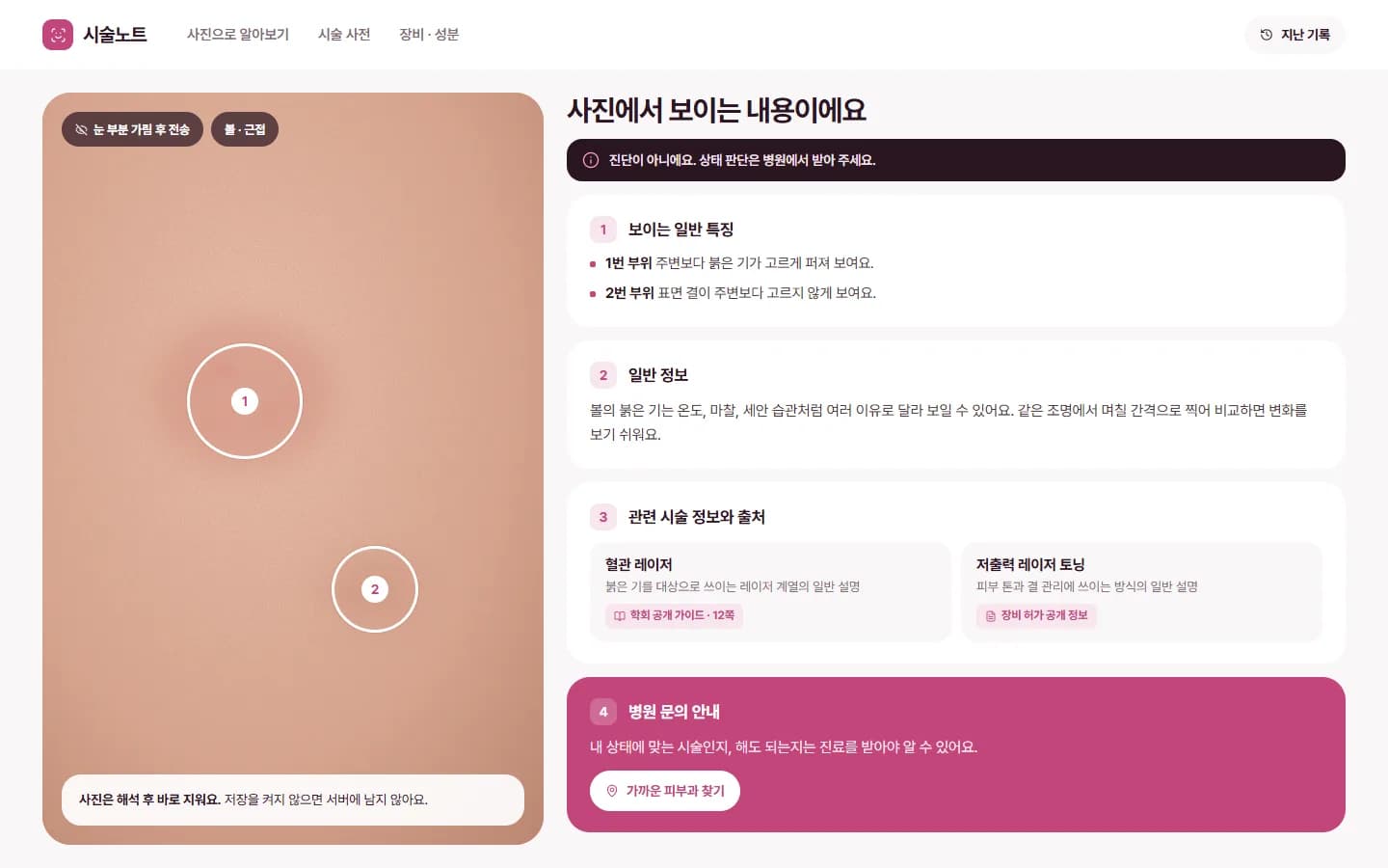 AI 사진 해석 · 시술 지식 DB 스크린샷 1